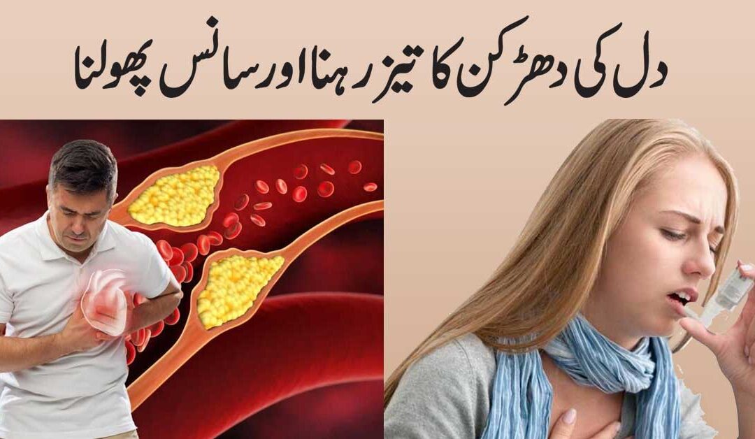 Saans Ka Phoolna Aur Dil Ki Dharkan Ka Tez Hona