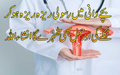 Bachedani Ki Rasoli Se Shifa Ka Taweez