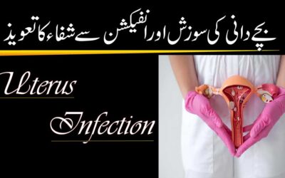 Bachedani Ki Sozish Aur Infection Ka Ilaj